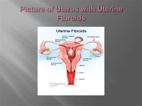 The Uterus Medical Terminology P1