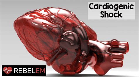 Cardiogenic Shock Rebel Em Emergency Medicine Blog