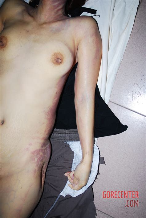 Dead Naked Woman In Morgue GoreCenter