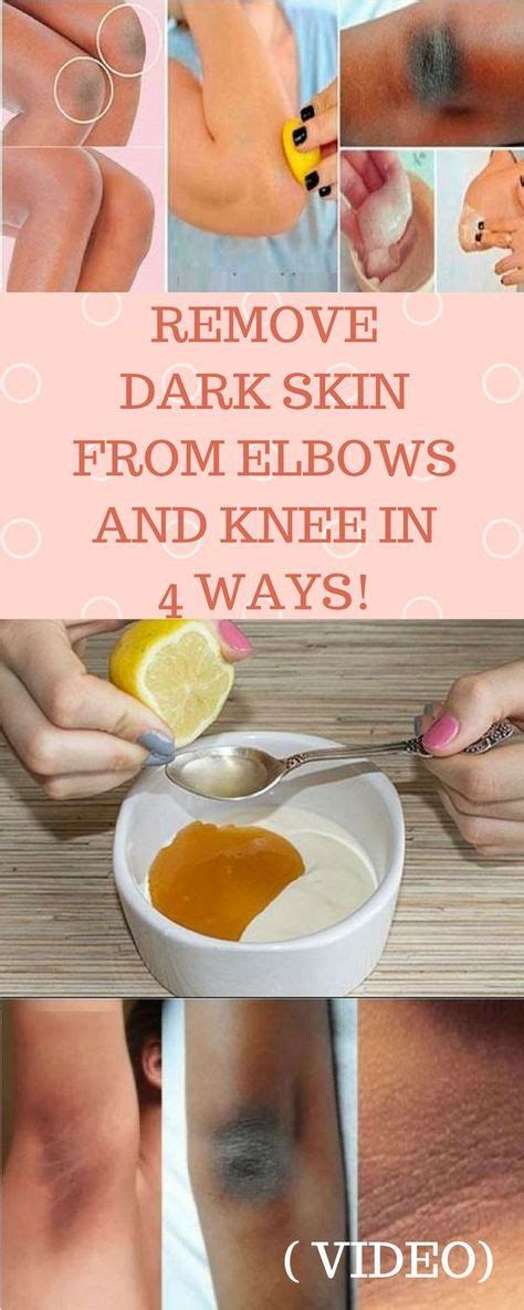 Remove Dark Skin From Elbows And Knees In 4 Days How To Remove