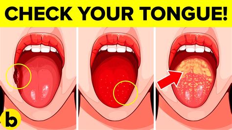 What Your Tongue Says About Your Health Youtube