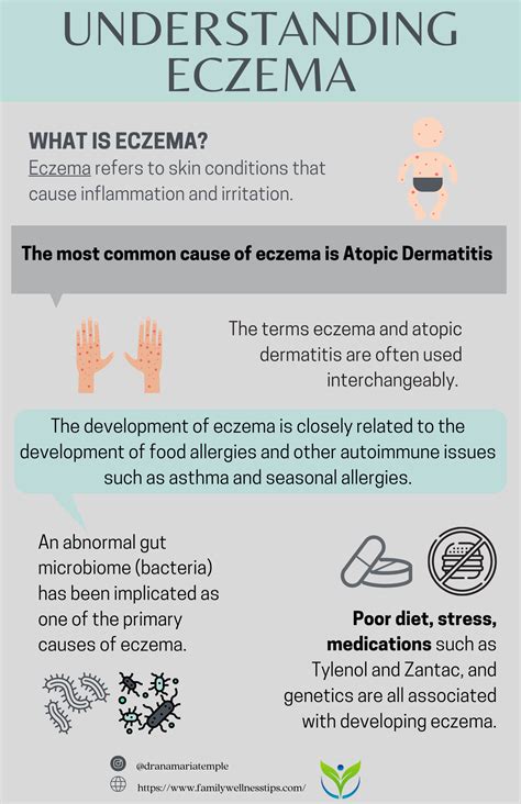Understanding Eczema Dr Ana Maria Temple