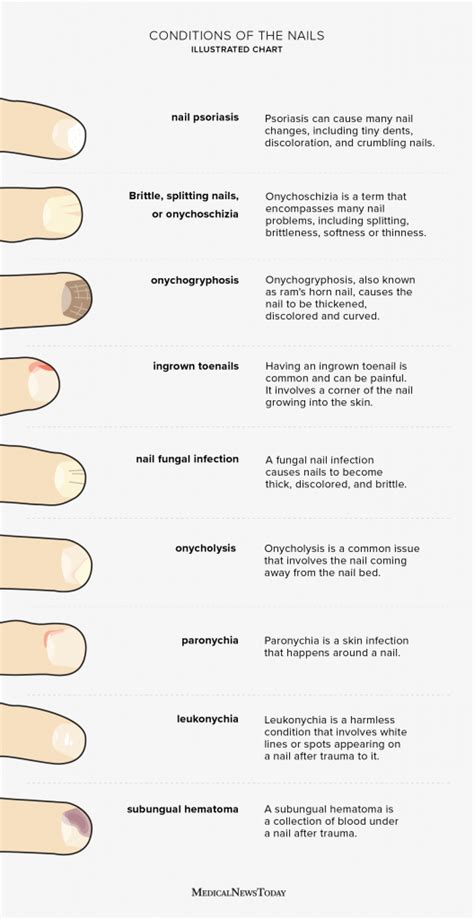 Nail Health Chart Common Problems And How To Treat Them