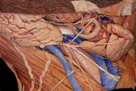 Superficial Views of Right Submandibular and Carotid Triangles