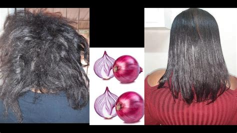 Grow Your Hair With Onion Learn What Onion Does To Your Hair Youtube