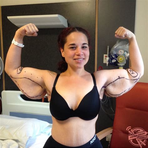 Meet The Woman Whose Extreme Weight Loss Left Her Needing Skin Removal