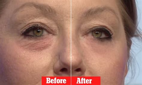 Instantly Ageless Cream Appears To Erase Eye Bags In 45 Seconds Daily Mail Online