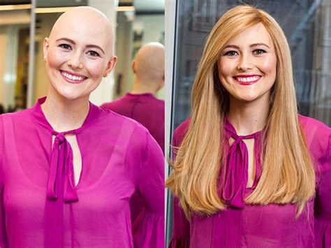 How To Choose Wigs For Cancer Patients Hair System