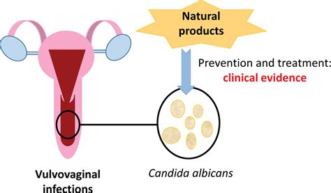 Natural Products For Vulvovaginal Candidiasis Treatment Evidence From