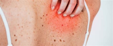 Endometrial cancer is staged as follows: BLEEDING MOLES Archives » Scary Symptoms
