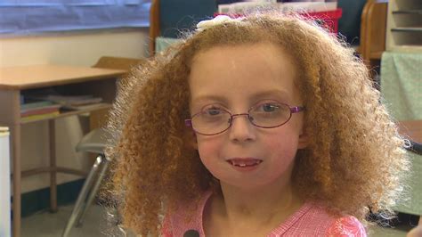 Girl With Rare Condition Born Without Jaw Komo