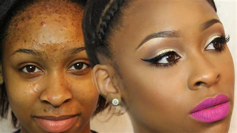 How To Cover Up Your Acne And Spots With Makeup Fabwoman