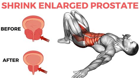 Kegel Workout Animation Pelvicfloor Exercises Shrink Enlarged Prostate Youtube