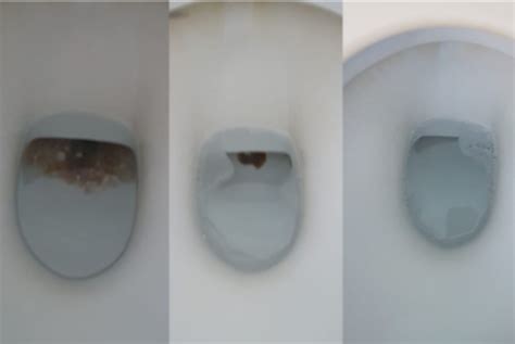 How To Clean A Toilet Bunnings Hack Removes Black Stains From Bowl NEWS