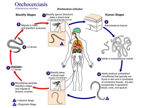 Onchocerciasis Onchocerca Volvulus Life Cycle 1 Grepmed