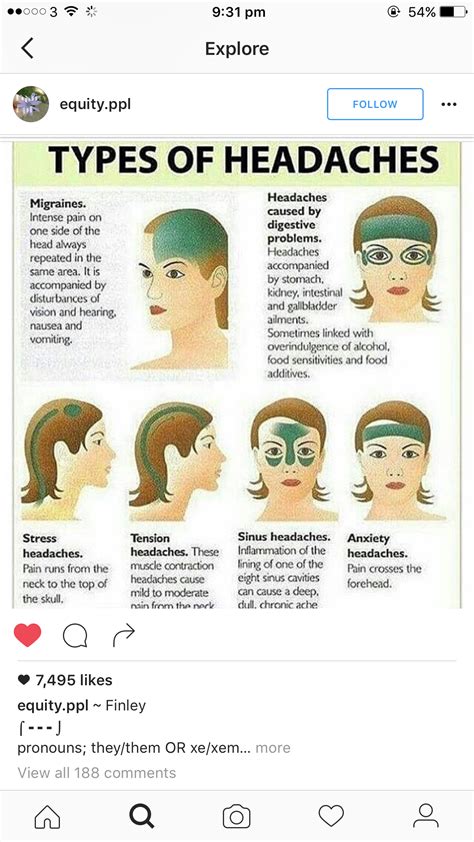 Types Of Headache Meme Headache