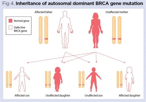 Genes And Chromosomes 4 Common Genetic Conditions Nursing Times