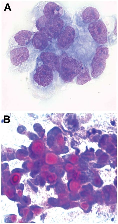 Overview And Evaluation Of The Value Of Fine Needle Aspiration Cytology