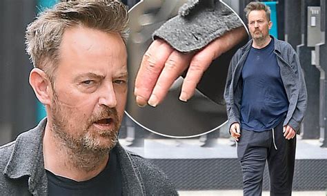 Matthew perry was photographed in good spirits on thursday while. Matthew Perry looks disheveled with long dirty fingernails ...