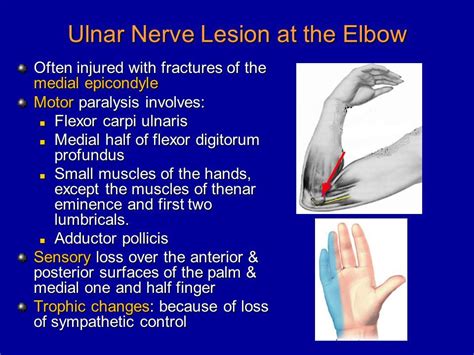 Image Result For Ulnar Nerve Palsy Ulnar Nerve Nerve Palsy Nerve