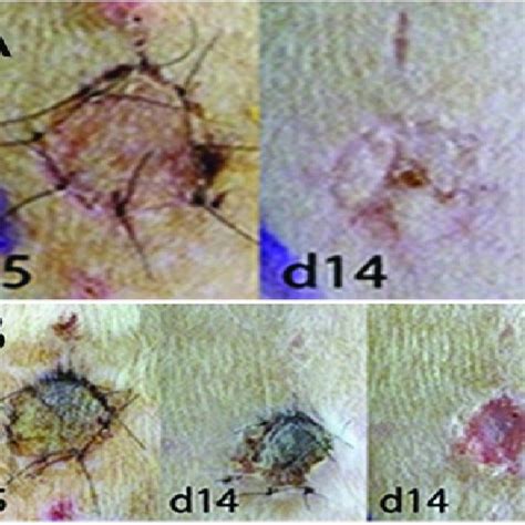 Burn Wounds By Cold Liquid Nitrogen In Rats C1d45 Appearance Of