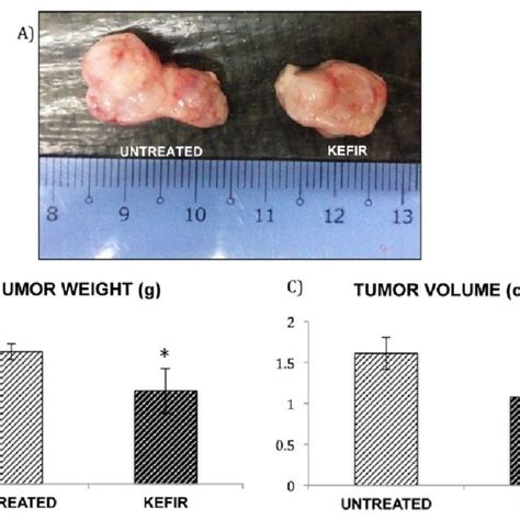 Tumor Size Weight G And Volume Cm 3 Obtained From 4t1