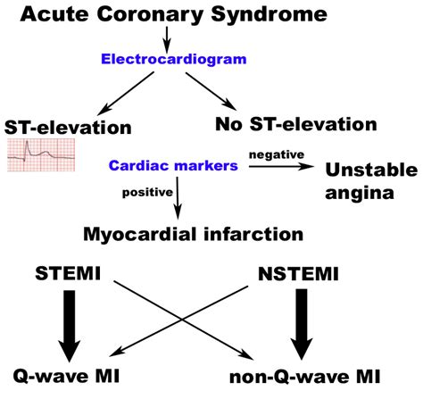 Acute Coronary Syndrome Physiopedia