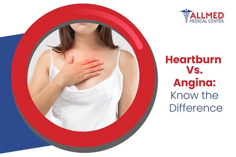 Heartburn Vs Angina Need To Know The Difference