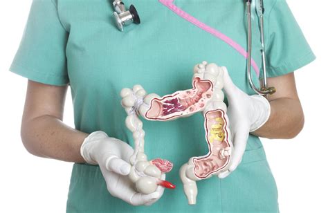 Colectomy Bowel Resection And Colon Surgery