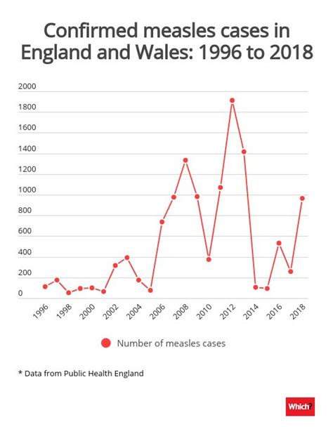 Measles Cases In England Almost Quadrupled In 2018 Which News