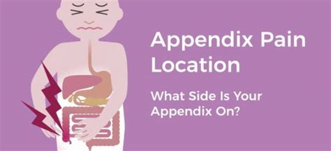 What Side Is Your Appendix On Appendicitis Symptoms Treatments