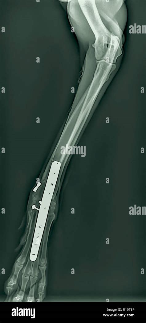 Right Foot Bones Hi Res Stock Photography And Images Alamy