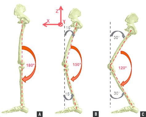 Global Position Of The Leg Model For Knee Flexion 0° A 30° B And