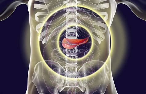La pancreatite è l'infiammazione del pancreas, una ghiandola che si trova dietro lo stomaco. Pancreatite cronica: come si diagnostica e come si cura ...
