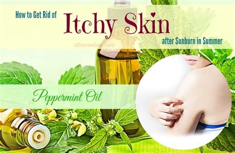 22 Remedies How To Get Rid Of Itchy Skin After Sunburn In Summer