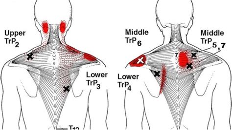 Try These 15 Stretches To Relieve A Stiff Neck Tight Shoulders And