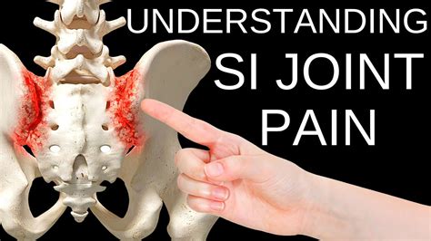 Simple Solutions To Sacroiliac Si Joint Pain Youtube