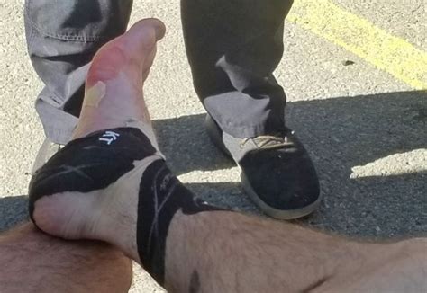 How To Prevent Blisters While Trail Running Run Infinite