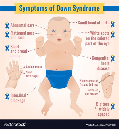 Clinical Symptoms Of Piriformis Syndrome Figure 4 Cli
