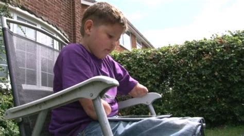 Boy With No Arms Or Legs Told He Must Prove He Is Disabled To Keep
