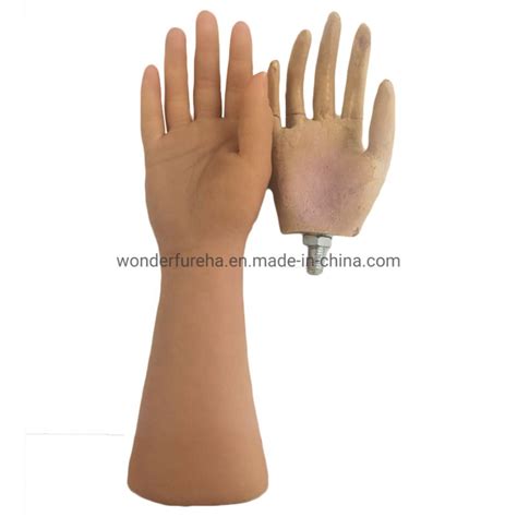Prosthetic Hand Orthopedic Implants Medical Prosthetics Hand Artificial