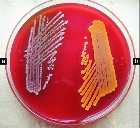Blood Agar Staphylococcus Aureus