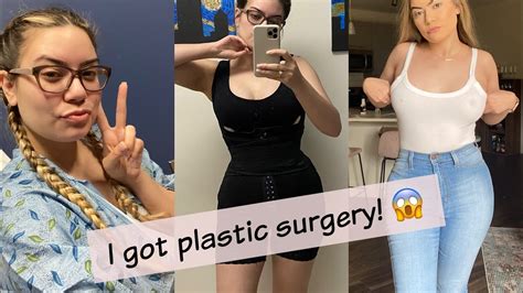 Bbl 360 Lipo And Breast Augmentation Plastic Surgery First Week Of