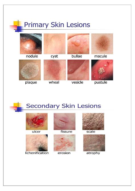 Primary Skin Lesions Chart