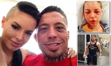 Porn Star Christy Mack Reveals Injuries Reportedly Inflicted By Her MMA Fighter Ex Babefriend Jon