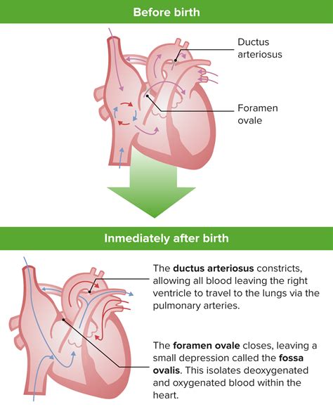 Heart Anatomy Foramen Ovale