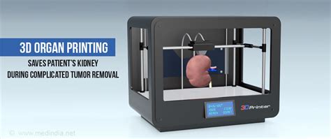 3D Organ Printing Saves Patient's Kidney During ...