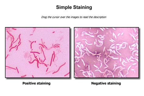 Simple Stains Microscopy Staining 101