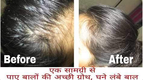 It contains a marine complex known as aminomar c. Promote Hair Growth and Reduce Hair Fall with one ...