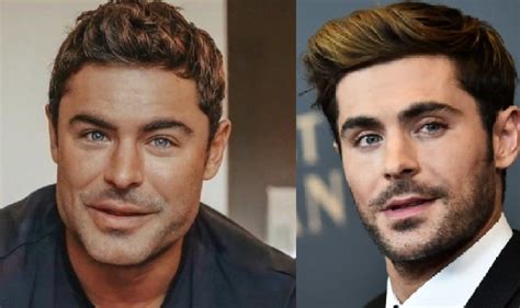 Did Zac Efron Get Jawline Plastic Surgery To Look Like Giga Chad Fans